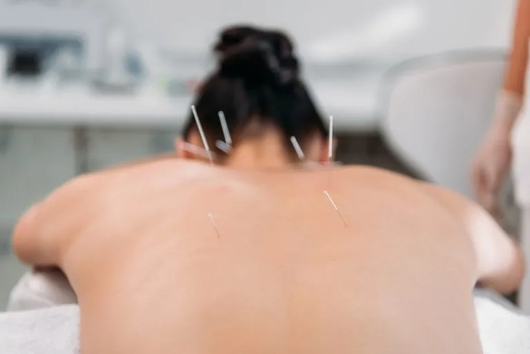 Acupuntura Oficializada: Nova Lei Define Quem Pode Praticar a Antiga Terapia no Brasil