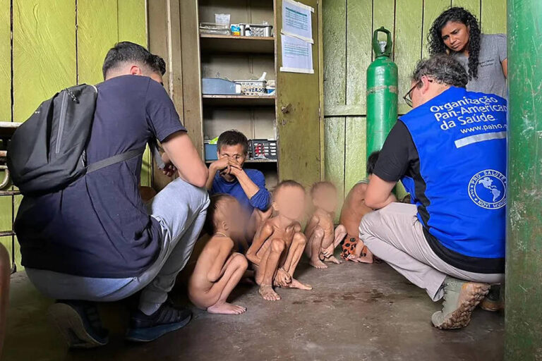 MPAM abre inquérito para apurar possível negligência no atendimento a crianças Yanomami desnutridas no Amazonas